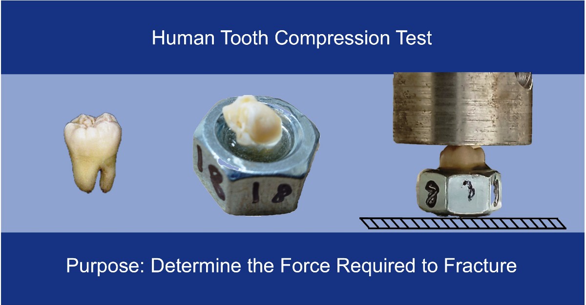 ASU Senior Thesis: Human Tooth Compression Test Featured Image